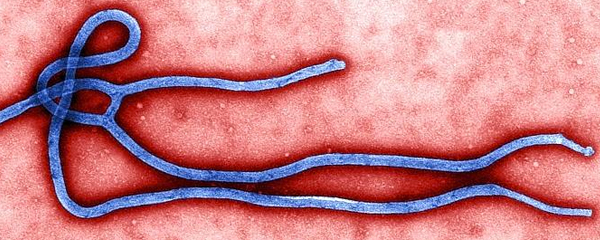 Immunité durable contre l’Ebola : Les américains sur la bonne voie